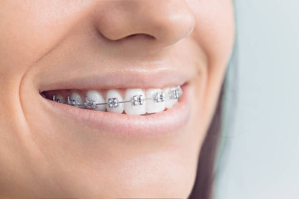 Dental Inlays and Onlays in Desert Hills, AZ